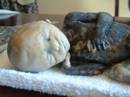 abortion2ndtrimester2